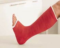 Gypsona Colour Cast