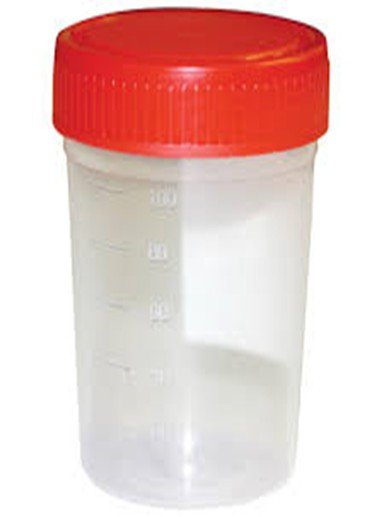 Urine Sample Cups